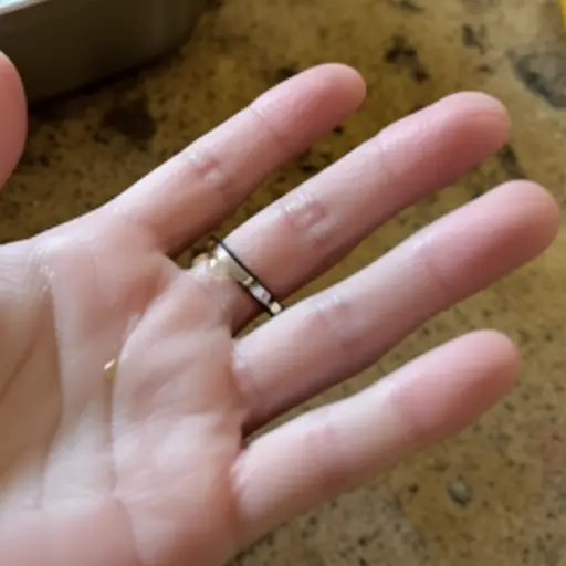 柠檬汁让我的伤口刺痛难忍。