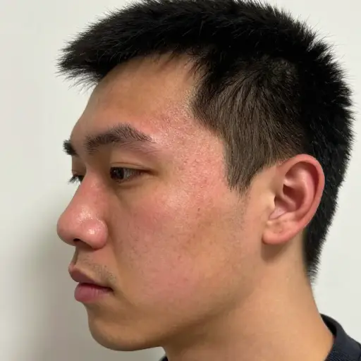他额头上的肿块开始消退了。