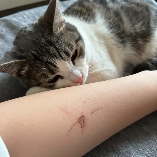 我手臂上有所有这些猫抓的痕迹。