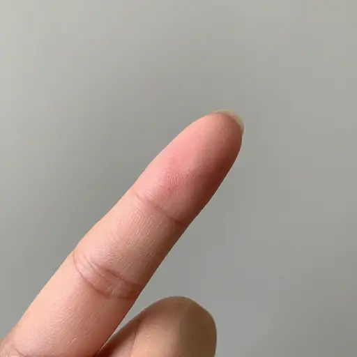 我手指上有一道割伤。